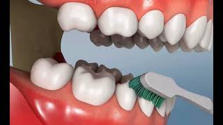 Technique ULTIME BROSSAGE des DENTS [upl. by Awra]