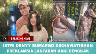 Istri Denny Sumargo Dikhawatirkan Preeklamsia Lantaran Kaki Bengkak di Trimester Akhir Kehamilan [upl. by Traci]