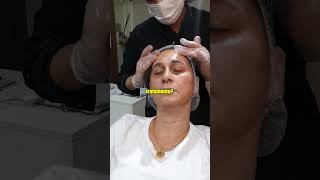 Dermaplaning  Tratamento Facial crismirandaestética cuidadoscomapele shoppingcontinental [upl. by Sokil377]