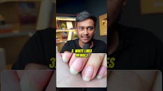 Check Your NAILS NOW shortsindia millionairemindset viralvideo [upl. by Ahsiekahs]