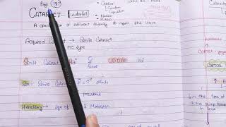 CataractSenile CataractPART 1 theory exam notes AK KHURANA [upl. by Uhile]