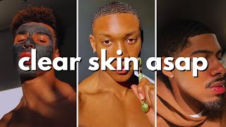 how to get clear skin for guys asap no bs guide [upl. by Livingstone330]