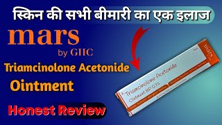 Triamcinolone Acetonide Ointment  Contact Dermatitis  Psoriasis Disease Treatment  Mars By GHC [upl. by Morlee]