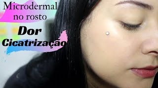 Tudo sobre meu microdermal [upl. by Ertnod99]