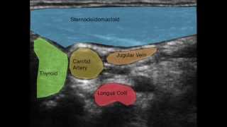 Ultrasound of the Deep Cervical Neck Flexors [upl. by Hsima]