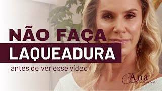 Não faça LAQUEADURA sem ver esse vídeo [upl. by Ilanos]