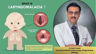 Laryngomalcia Stridor Symptoms Diagnosis amp Treatment I Dr Ankit Parakh Child Pulmonologist [upl. by Solhcin]