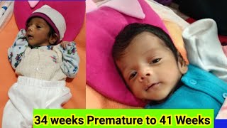 Premature baby weight gain  34 weeks delivery  delivery in 34 weeks  babyboy ivfsuccess [upl. by Harewood922]