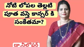 Leukoplakia Telugu Oral Cancer Precancerous Lesions Leukoplakia Symptoms Leukoplakia Causes [upl. by Midas487]