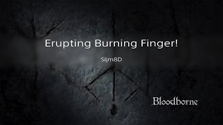 Erupting Burning Finger [upl. by Ezra]