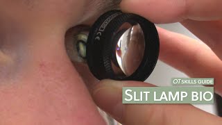 OT skills guide Slit lamp bio [upl. by Seyler]