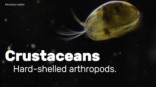 Crustaceans  hard  shelled arthropods seen under the microscope [upl. by Cohette]