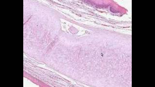 Shotgun Histology Epiglottis [upl. by Oiciruam]