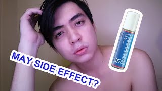 SOS CLINDAMYCIN  SIDE EFFECT AND EVERYTHING [upl. by Wendell]