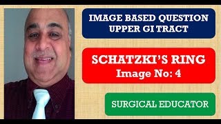 SCHATZKIS RING UPPER GI TRACT Image Based Questions [upl. by Iverson353]