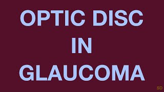 Glaucoma Session 06 Clinical Evaluation of a Glaucoma Patient Part 3 Fundus Examination [upl. by Vedi]