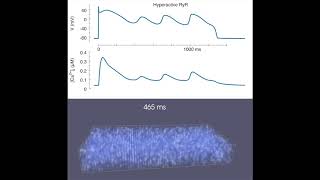 NCXmediated Subcellular Ca2 Dynamics Underlying Early Afterdepolarizations in LQT2 Cardiomyocytes [upl. by Anett]