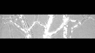 Nuclear traffic in a filamentous fungus [upl. by Othilie]