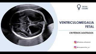 Ventriculomegalia fetal como avaliar [upl. by Cowden]