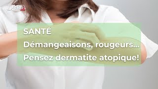 Santé Démangeaisons rougeurs Pensez dermatite atopique [upl. by Anire]