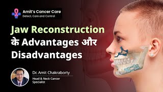 Jaw Reconstruction के Advantages और Disadvantages  What to Expect  Dr Amit Chakraborty [upl. by Caras]