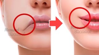 Lift Lip Corners Fix Droopy Mouth Corners Fat Around The Mouth Sagging CheeksNO SURGERY  NO2 [upl. by Orimlede]