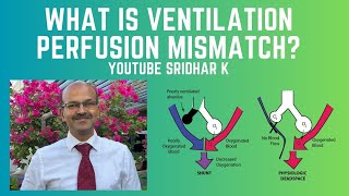 What is ventilationperfusion VQ mismatch How do we manage it neonatalventilation VQmismatch [upl. by Nyraa]