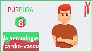 EPISODE7 sémiologie cardiovasculaire purpura [upl. by Nytsyrk922]