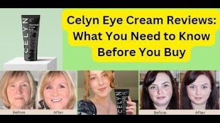 Celyn Eye Cream Reviews what you need to Know [upl. by Hunger]