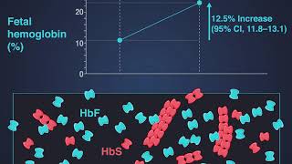 Hydroxyurea for Sickle Cell Anemia [upl. by Dorran]