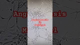 Angiogenesis in the Matrigel endothelial cells from heart researcherlife reseach shorts heart [upl. by Aicatsue411]