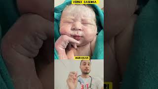 Vernix Caseosa babyborn newbornbaby newborn MRAnsari7987 cutebaby cutebabystatus viral [upl. by Brenan]