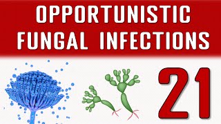 Opportunistic Fungal infections [upl. by Ynattir824]