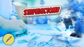 Stapedectomy  Everything Surgeries ✅😬⁉️ [upl. by Eedeed]