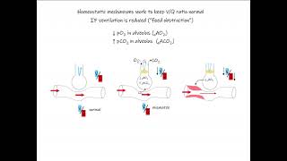 42 Ventilation Perfusion [upl. by Callean]