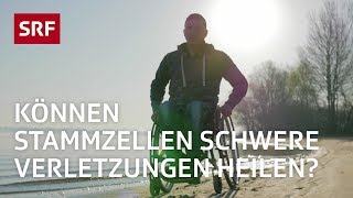 Stammzellen Ein Wundermittel der Medizin  Erklärvideo  SRF [upl. by Naud]