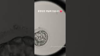 모자이시즘 배아 분열과정 Embryoscope timelapse 시험관 난임 5일배양 모자이시즘 pgt염색체 배아분열과정 [upl. by Nonnahsal569]