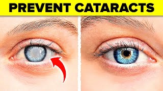 The Absolute BEST Way to Prevent Cataracts [upl. by Priestley]