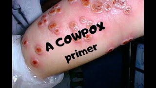 COWPOX A primer on a now rare infection [upl. by Etnelav]