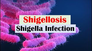 Shigellosis Shigella “A Cause of Bloody Diarrhea” Pathophysiology Symptoms Diagnosis Treatment [upl. by Imeon671]