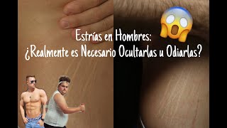 Estrías en los hombres  Cómo combatirlas [upl. by Vtehsta]