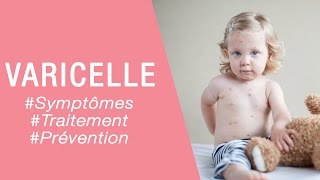 La varicelle chez lâ€™enfant  Maladies infantiles [upl. by Aneelahs]