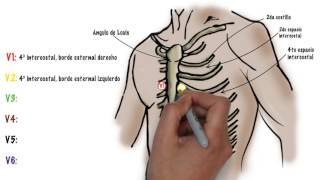 Como hacer un ECG electrocardiograma [upl. by Ttennej608]