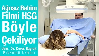 Ağrısız Rahim Filmi HSG böyle çekiliyor  Animasyonlu gerçek video [upl. by Batish162]