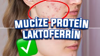 Mucize Protein LAKTOFERRİN Nedir Nasıl Kullanılır Faydaları Nelerdir SİVİLCE SORUN OLMASIN [upl. by Keare471]