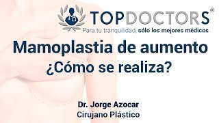 Mamoplastia de aumento ¿Cómo se realiza el aumento mamario [upl. by Leontina]