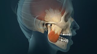 TMJ Pain Headaches Earaches and Spasms [upl. by Bartle828]