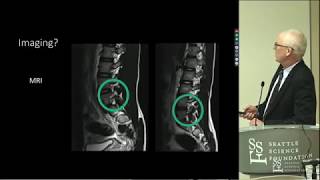 Spondylolysis amp Spondylolisthesis  Wally Krengel MD [upl. by Ume]