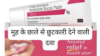 triamcinolone acetonide buccal pastetriamcinolone acetonide buccal paste uses in hindi [upl. by Lertsek]