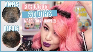 ✅ E FUNCIONA RESULTADOS DESAFIO BIOPLEX NASCE FIOS  SOFT HAIR Crescimento Comprovado [upl. by Annayar]